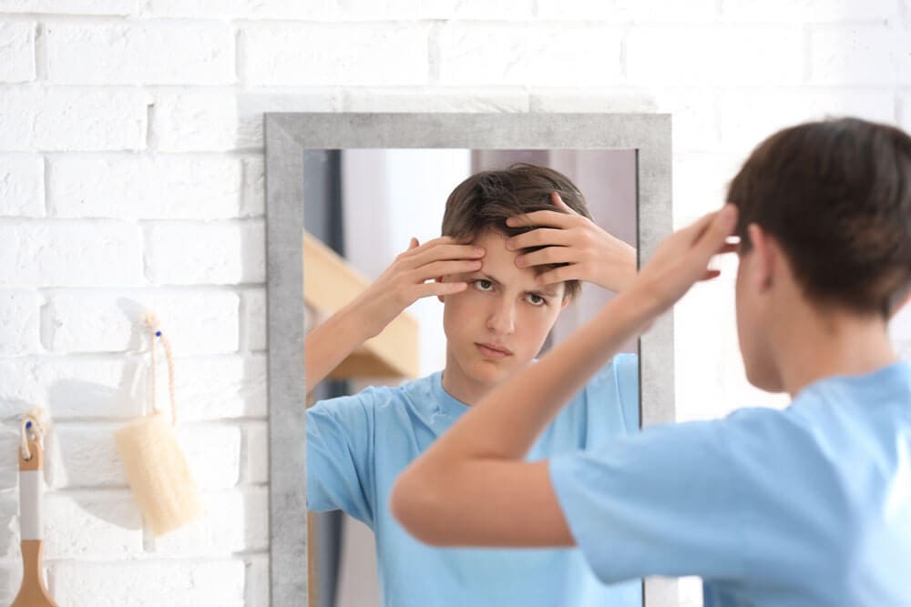 Teenage Acne Guide: Causes, Types & Effective Treatment Tips